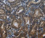 MEI1 Antibody in Immunohistochemistry (Paraffin) (IHC (P))