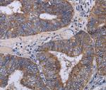 MT3 Antibody in Immunohistochemistry (Paraffin) (IHC (P))