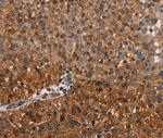 NMT2 Antibody in Immunohistochemistry (Paraffin) (IHC (P))