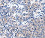 KCNH8 Antibody in Immunohistochemistry (Paraffin) (IHC (P))