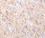 KISS1 Antibody in Immunohistochemistry (Paraffin) (IHC (P))