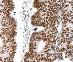 LIFR Antibody in Immunohistochemistry (Paraffin) (IHC (P))