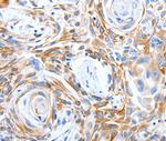 LRIG3 Antibody in Immunohistochemistry (Paraffin) (IHC (P))