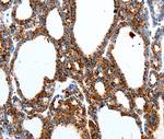 MTNR1A Antibody in Immunohistochemistry (Paraffin) (IHC (P))