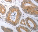 RBMS3 Antibody in Immunohistochemistry (Paraffin) (IHC (P))