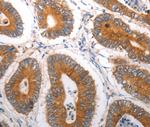 KCC3 Antibody in Immunohistochemistry (Paraffin) (IHC (P))