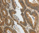 SPAG4L Antibody in Immunohistochemistry (Paraffin) (IHC (P))