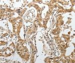 SPAG4L Antibody in Immunohistochemistry (Paraffin) (IHC (P))