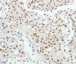 TCF2 Antibody in Immunohistochemistry (Paraffin) (IHC (P))