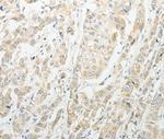 CCP4 Antibody in Immunohistochemistry (Paraffin) (IHC (P))