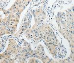 CCP4 Antibody in Immunohistochemistry (Paraffin) (IHC (P))