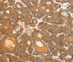 Secretin Antibody in Immunohistochemistry (Paraffin) (IHC (P))