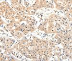 SLC27A1 Antibody in Immunohistochemistry (Paraffin) (IHC (P))