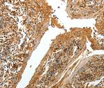 Tenascin R Antibody in Immunohistochemistry (Paraffin) (IHC (P))