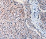 FAT4 Antibody in Immunohistochemistry (Paraffin) (IHC (P))