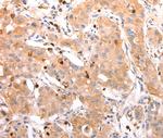 CELSR2 Antibody in Immunohistochemistry (Paraffin) (IHC (P))