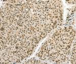 Angiopoietin 4 Antibody in Immunohistochemistry (Paraffin) (IHC (P))