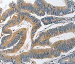 PIK3R4 Antibody in Immunohistochemistry (Paraffin) (IHC (P))