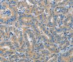 PIK3R4 Antibody in Immunohistochemistry (Paraffin) (IHC (P))