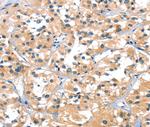 SLC6A4 Antibody in Immunohistochemistry (Paraffin) (IHC (P))