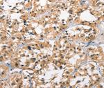 GPR182 Antibody in Immunohistochemistry (Paraffin) (IHC (P))