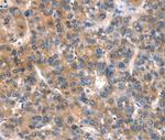 CaV2.1 Antibody in Immunohistochemistry (Paraffin) (IHC (P))