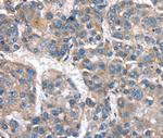 CaV3.1 Antibody in Immunohistochemistry (Paraffin) (IHC (P))