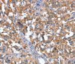 CaV3.1 Antibody in Immunohistochemistry (Paraffin) (IHC (P))