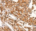 DDAH2 Antibody in Immunohistochemistry (Paraffin) (IHC (P))