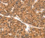 SPINLW1 Antibody in Immunohistochemistry (Paraffin) (IHC (P))