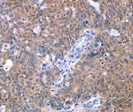 HDBP2 Antibody in Immunohistochemistry (Paraffin) (IHC (P))