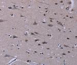 ID3 Antibody in Immunohistochemistry (Paraffin) (IHC (P))