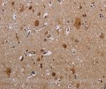 MAGEB18 Antibody in Immunohistochemistry (Paraffin) (IHC (P))