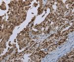 MAGEB18 Antibody in Immunohistochemistry (Paraffin) (IHC (P))