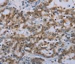 MED12 Antibody in Immunohistochemistry (Paraffin) (IHC (P))