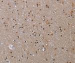 MED12 Antibody in Immunohistochemistry (Paraffin) (IHC (P))