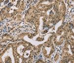 CENPV Antibody in Immunohistochemistry (Paraffin) (IHC (P))