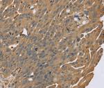 ZMIZ1 Antibody in Immunohistochemistry (Paraffin) (IHC (P))