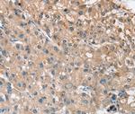 RRAS Antibody in Immunohistochemistry (Paraffin) (IHC (P))