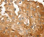 SESN2 Antibody in Immunohistochemistry (Paraffin) (IHC (P))