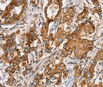 SLC5A11 Antibody in Immunohistochemistry (Paraffin) (IHC (P))