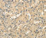 UBAP1 Antibody in Immunohistochemistry (Paraffin) (IHC (P))