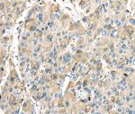 INHBB Antibody in Immunohistochemistry (Paraffin) (IHC (P))