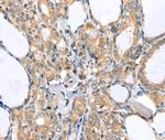 LLGL2 Antibody in Immunohistochemistry (Paraffin) (IHC (P))