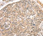 LONP1 Antibody in Immunohistochemistry (Paraffin) (IHC (P))