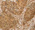 VMP1 Antibody in Immunohistochemistry (Paraffin) (IHC (P))