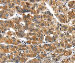 UBAP2 Antibody in Immunohistochemistry (Paraffin) (IHC (P))