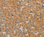 PMAT Antibody in Immunohistochemistry (Paraffin) (IHC (P))