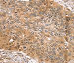 SNX11 Antibody in Immunohistochemistry (Paraffin) (IHC (P))