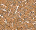 SNX11 Antibody in Immunohistochemistry (Paraffin) (IHC (P))